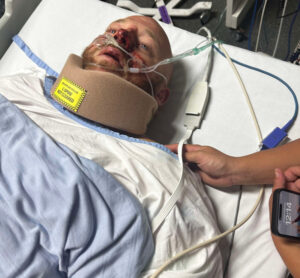 Tradie crushed in machinery accident